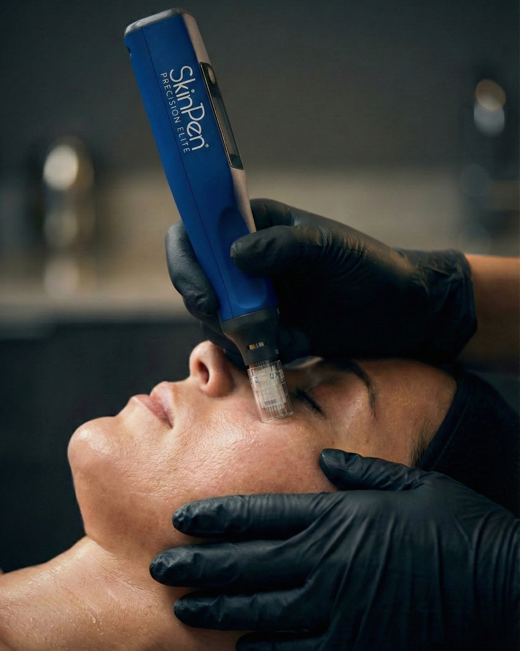 SkinPen Elite Microneedling