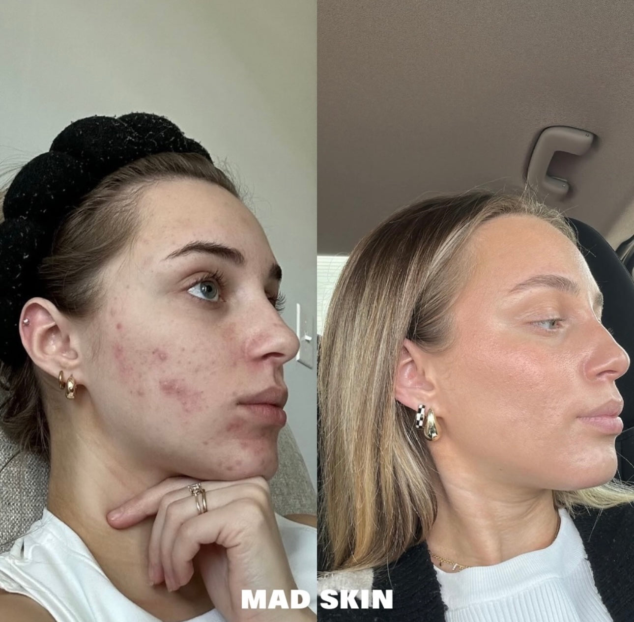 Customized At-Home Skincare