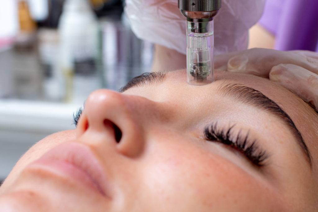 MAD Exceed Microneedling Unlocking Skin Rejuvenation with Advanced Micro-Needling Technology